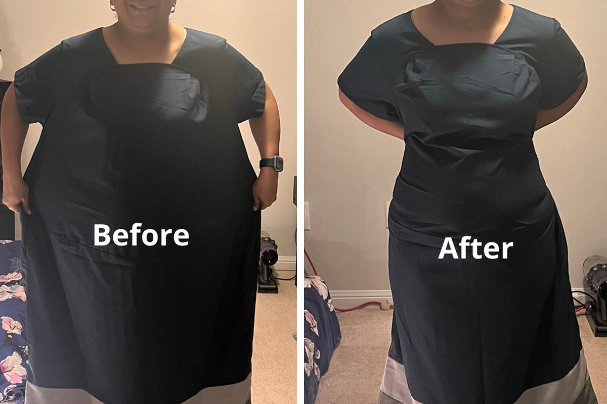 RS-before-after